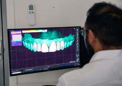 CEREC Crowns: In, Done, and Out in One Day