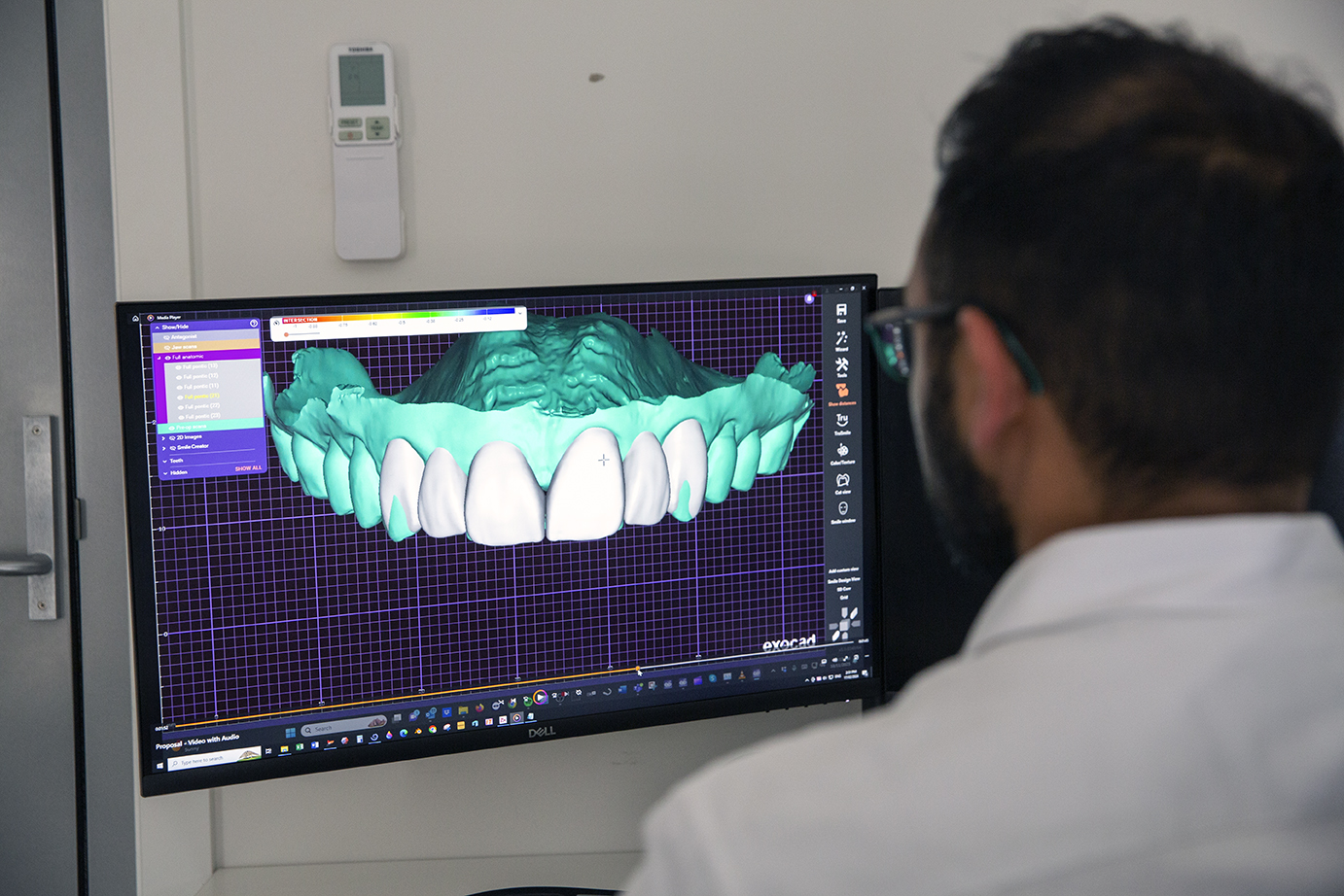 CEREC Crowns: In, Done, and Out in One Day
