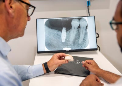 Dental Implants vs Dentures: Understanding Your Options in Warragul