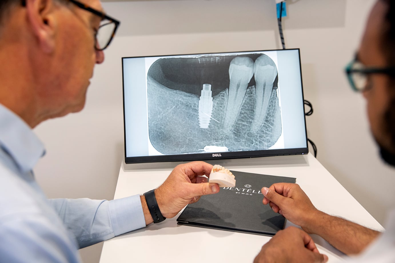 Dental Implants vs Dentures: Understanding Your Options in Warragul