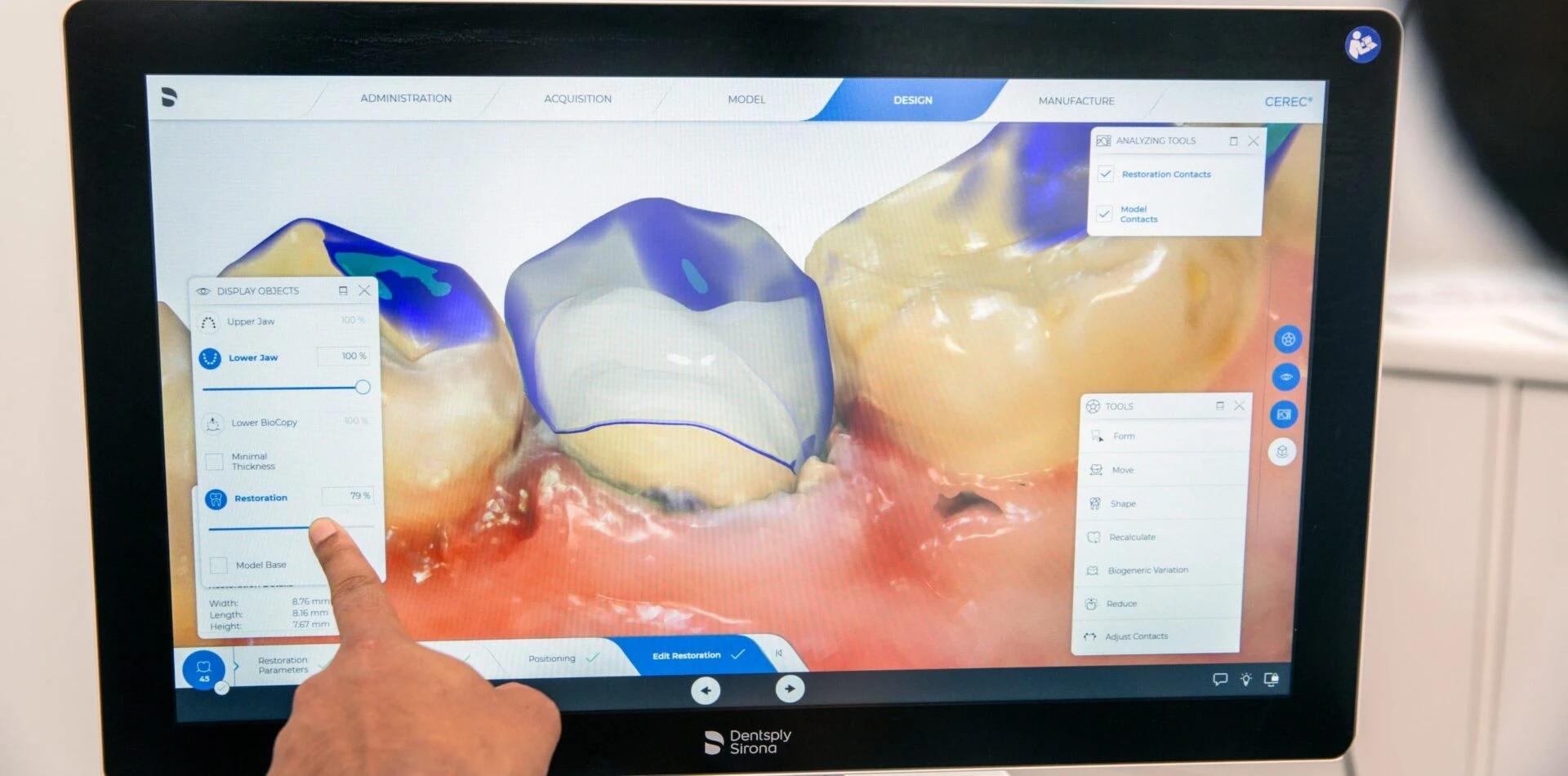Dental Crowns And Bridges In Warragul Gippsland, In Warragul Dental Care