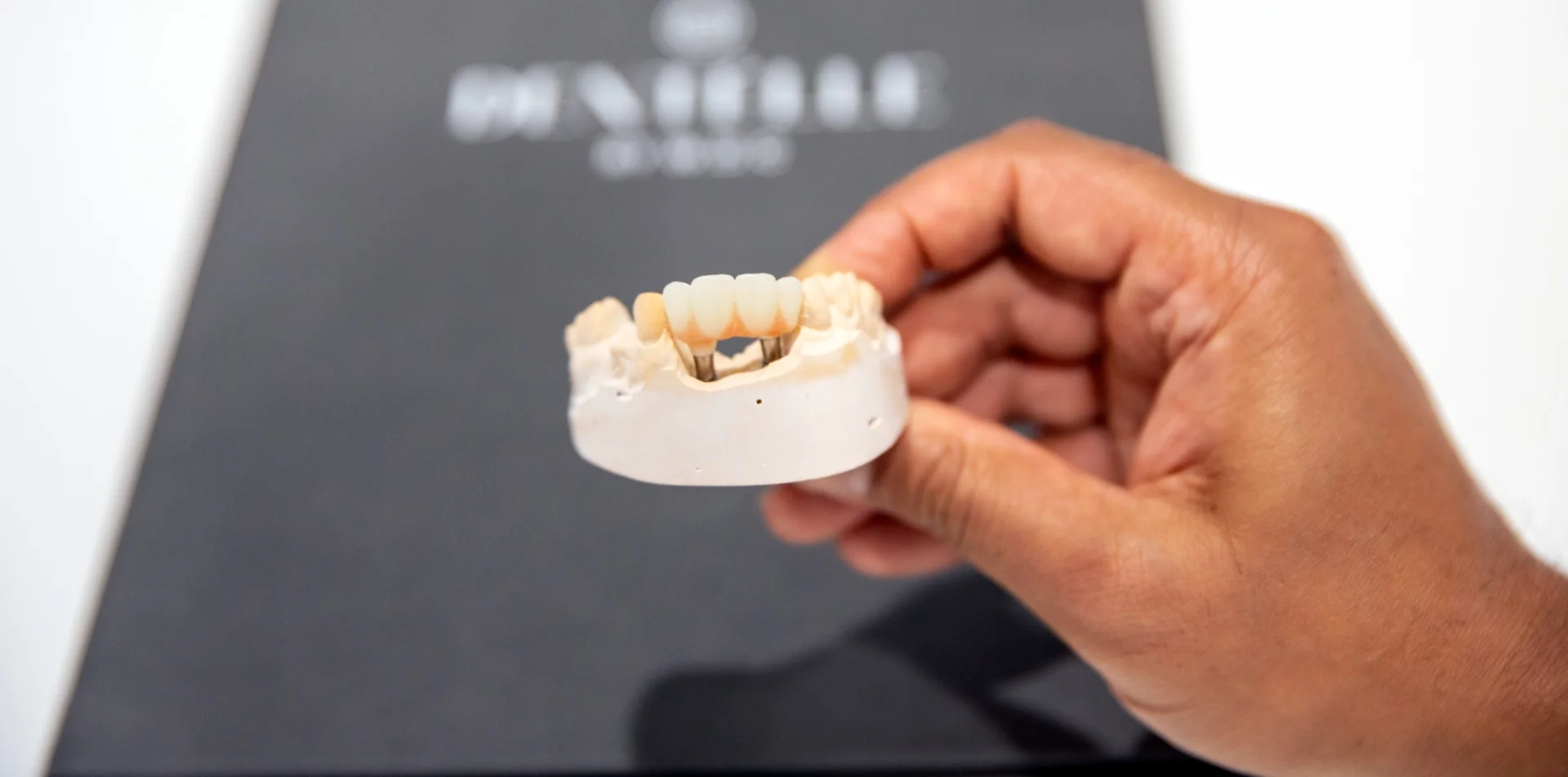 Dental Implants In Warragul, Gippsland In Warragul Dental Care