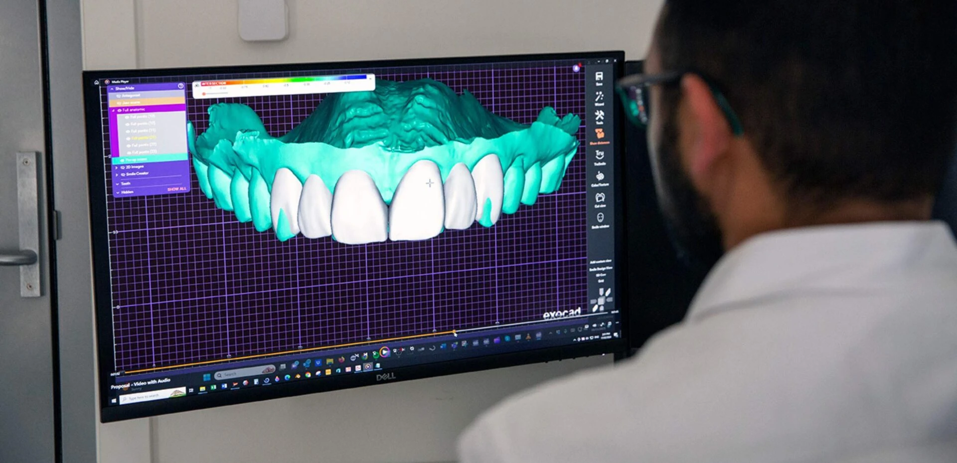 Digital Smile Design At Warragul, Gippsland In Warragul Dental Care