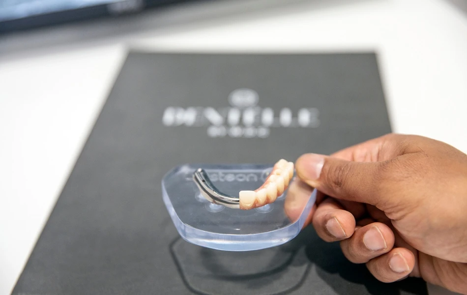 How Long Does The All-on-4 Treatment Last And How Do I Maintain It? In Warragul, Gippsland At Warragul Dental Care