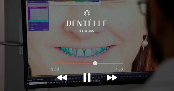 What Is A Digital Smile Design