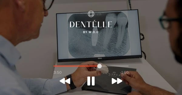 What’s The Difference Between Implant-supported Dentures And All-on-4 Implants? At Warragul, Gippsland In Warragul Dental Care